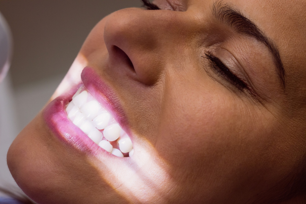 Clareamento dentário em casa realmente funciona? 3 formas de branquear os dentes 2