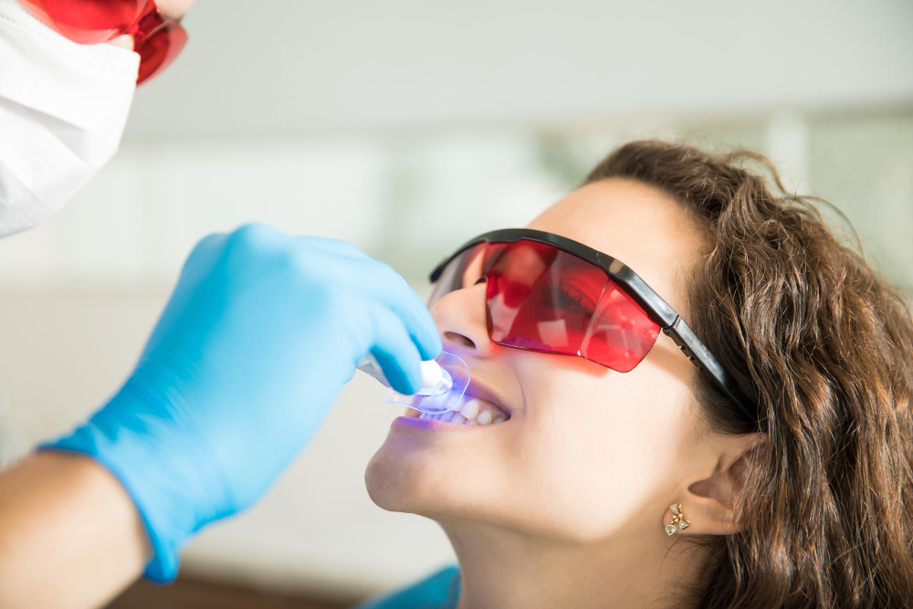 Clareamento dentário em casa realmente funciona? 5 Clareamento dentário em casa